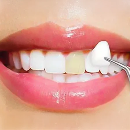 Dentist Cave Creek AZ Restorative Dentistry Service